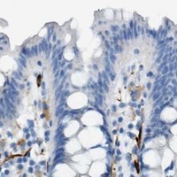 HPA IHC Colon — MYH11