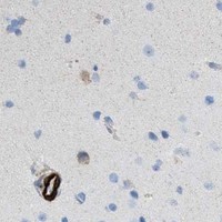 HPA IHC Cerebral cortex — MYH11