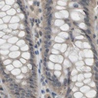 HPA IHC Colon — SRR