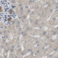 HPA IHC Liver — SRR