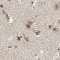HPA IHC Cerebral cortex — SRR