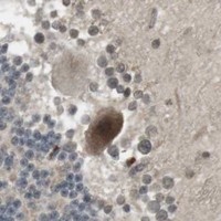 HPA IHC Cerebellum — SRR