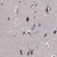 HPA IHC Cerebral cortex — GSR