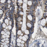 HPA IHC Colon — HADHA
