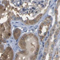 HPA IHC Kidney — HADHA