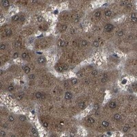 HPA IHC Liver — HADHA