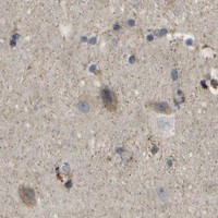 HPA IHC Cerebral cortex — HADHA