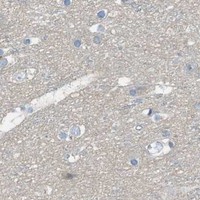 HPA IHC Cerebral cortex — TIMD4