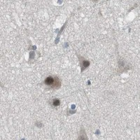 HPA IHC Cerebral cortex — PBRM1