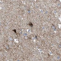 HPA IHC Cerebral cortex — RBBP9
