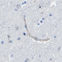 HPA IHC Cerebral cortex — SORBS3