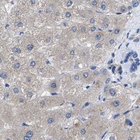 HPA IHC Liver — HSPB8