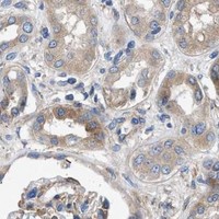 HPA IHC Kidney — HSPB8