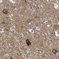 HPA IHC Cerebral cortex — HSPB8
