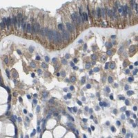 HPA IHC Colon — CTNND1