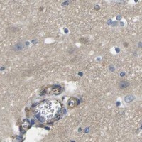 HPA IHC Cerebral cortex — CTNND1