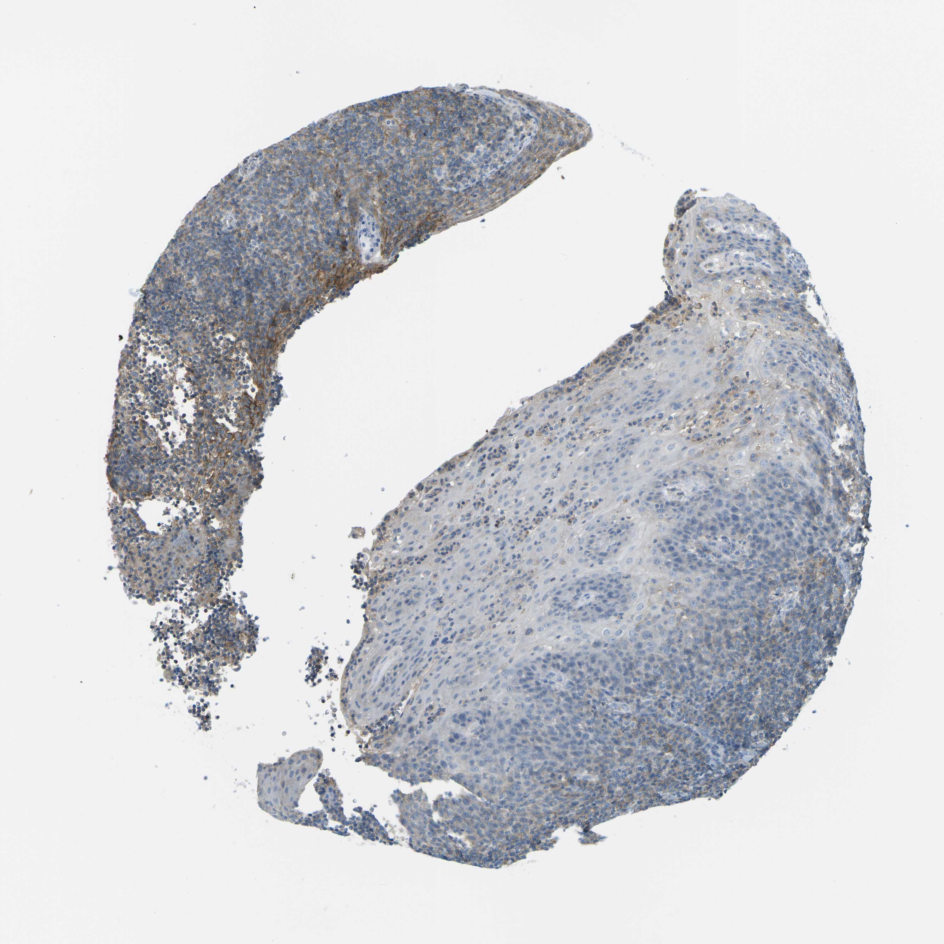 Tissue expression of CD47 Staining in tonsil The Human Protein Atlas