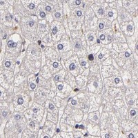 HPA IHC Liver — TLR8