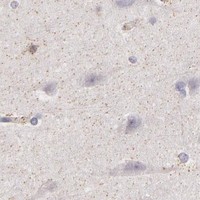 HPA IHC Cerebral cortex — TLR8