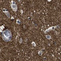 HPA IHC Cerebral cortex — NECTIN1