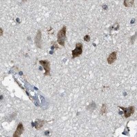 HPA IHC Cerebral cortex — RAD51B