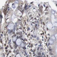 HPA IHC Colon — SPIN1