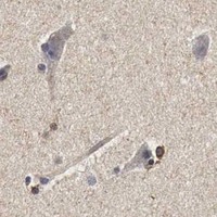 HPA IHC Cerebral cortex — SPIN1