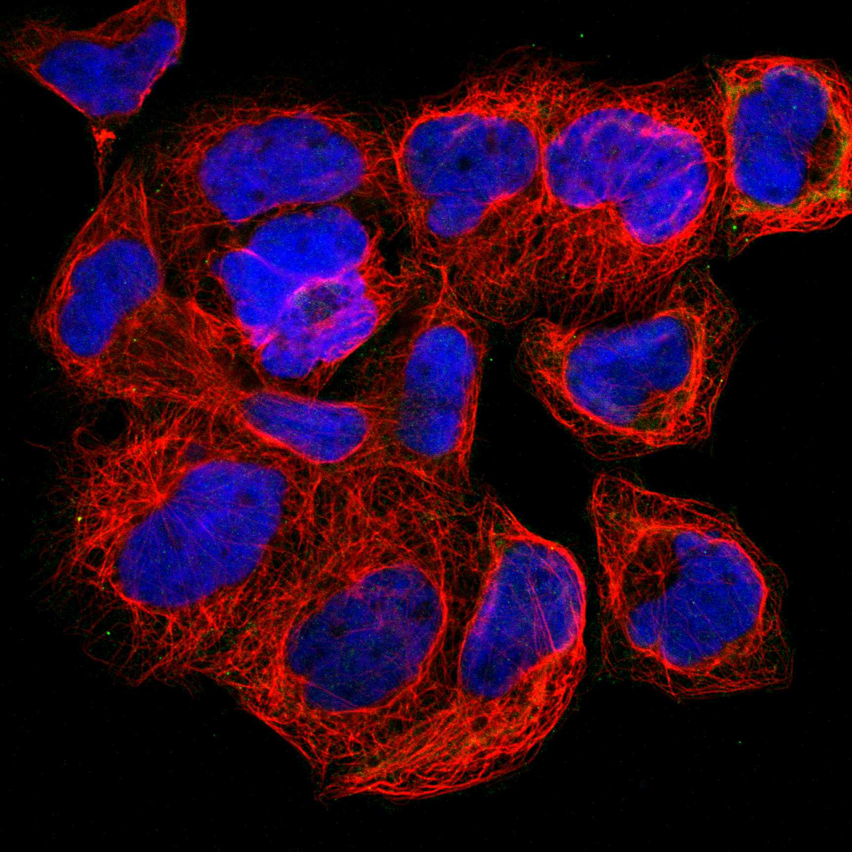 Subcellular PNP The Human Protein Atlas