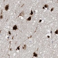 HPA IHC Cerebral cortex — ALYREF