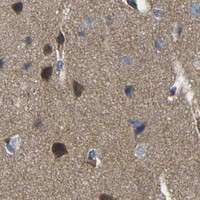 HPA IHC Cerebral cortex — DLG1