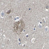 HPA IHC Caudate — DLG1
