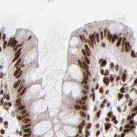 HPA IHC Colon — RBM22