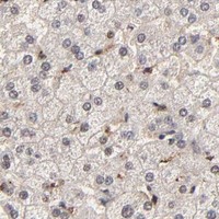 HPA IHC Liver — RBM22