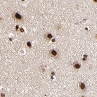 HPA IHC Cerebral cortex — RBM22