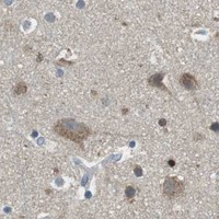 HPA IHC Cerebral cortex — BACE1