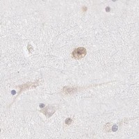 HPA IHC Cerebral cortex — DDX3Y
