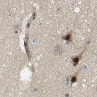 HPA IHC Cerebral cortex — ARID1B