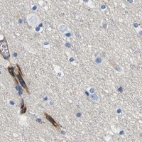 HPA IHC Cerebral cortex — ORAI1