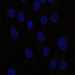 HPA016624: hTERT-RPE1 (serum starved)