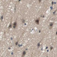 HPA IHC Cerebral cortex — KCNQ5