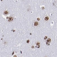 HPA IHC Cerebral cortex — HNRNPA1