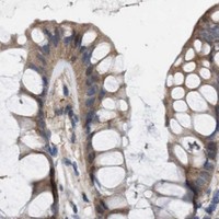 HPA IHC Colon — CSNK1A1