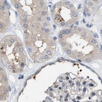 HPA IHC Kidney — CSNK1A1