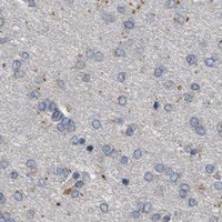 HPA IHC Cerebral cortex — CSNK1A1