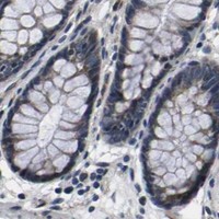 HPA IHC Colon — CCNE1