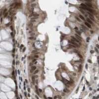 HPA IHC Colon — KAT5