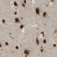 HPA IHC Cerebral cortex — KAT5