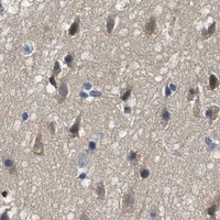 HPA IHC Cerebral cortex — LTA4H