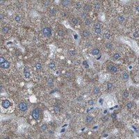 HPA IHC Liver — PPFIA1
