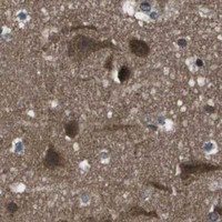 HPA IHC Cerebral cortex — PPFIA1